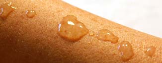 Water droplets rest on top of the skin on someone's arm